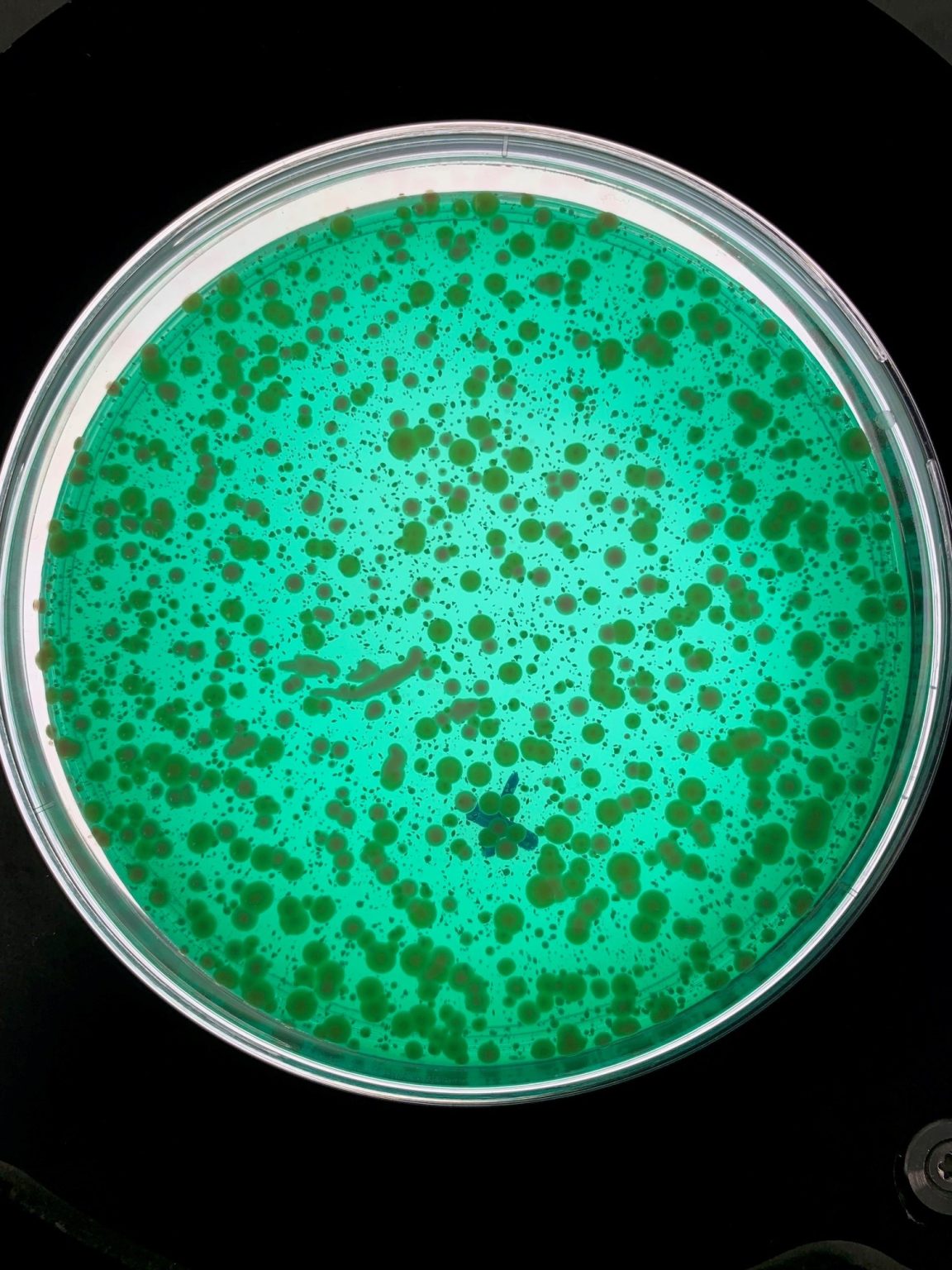 Gros plan sur une analyse microbiologique