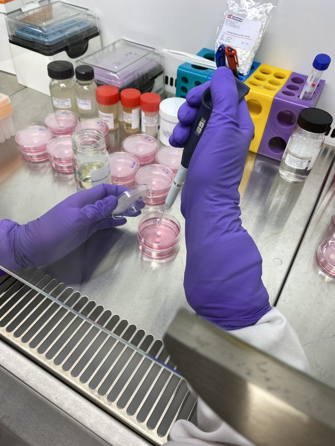 Professionnel de laboratoire avec des gants violets et une pipette réalisant une expérience
