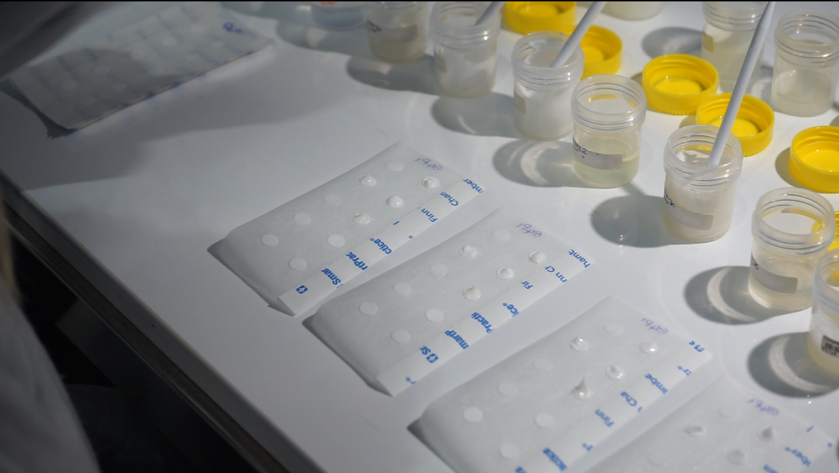 Patch tests posé sur une table de laboratoire