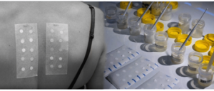 Le Patch Test - Groupe CCA